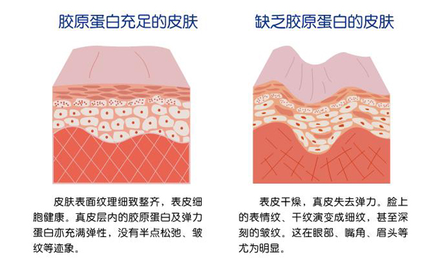 膠原蛋白.jpg